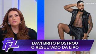 Davi Brito mostra resultado de lipo HD e divide opiniões | Fofocalizando 19/05/25